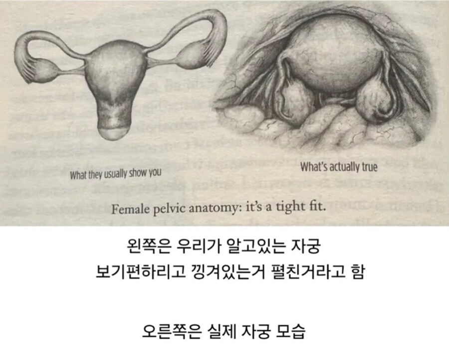 자궁 모양_1.jpg