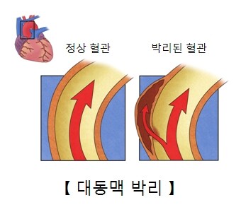사람은 쉽게 안죽는다라는 말이 공감이 안되더라_1.jpg