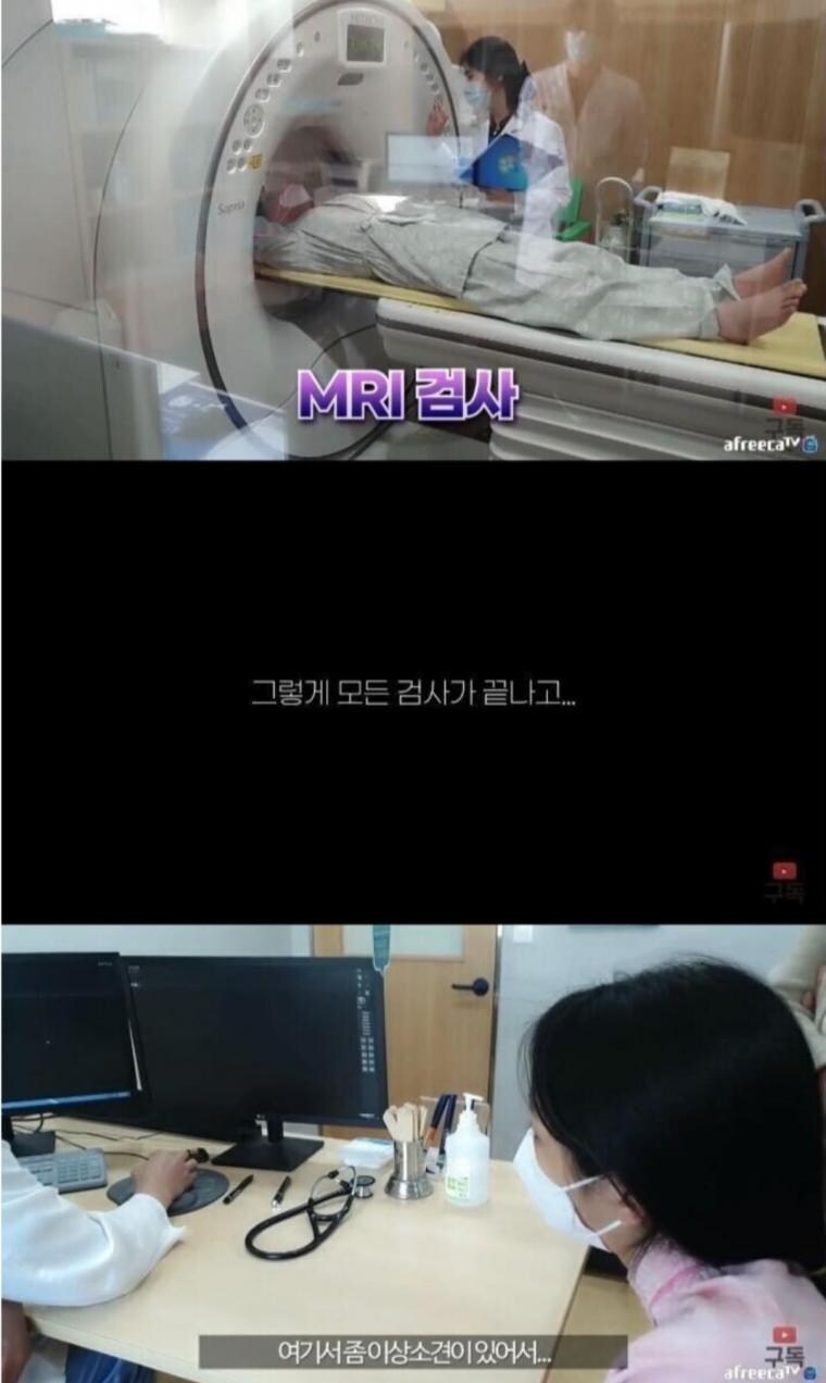 정말 운좋게 췌장암 발견해서 치료받은 유튜버_2.jpg