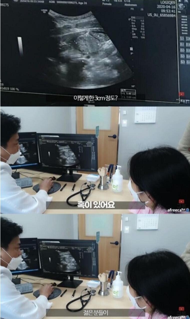정말 운좋게 췌장암 발견해서 치료받은 유튜버_3.jpg