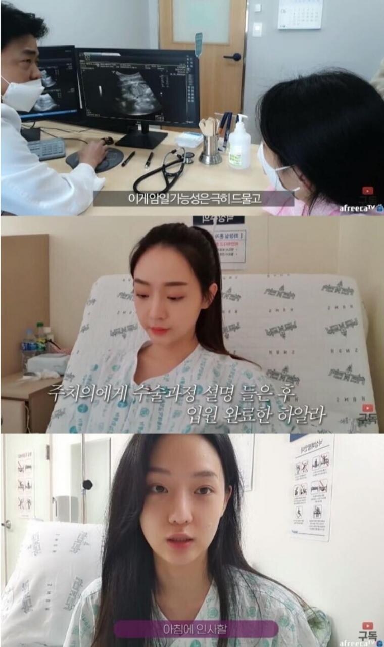 정말 운좋게 췌장암 발견해서 치료받은 유튜버_4.jpg