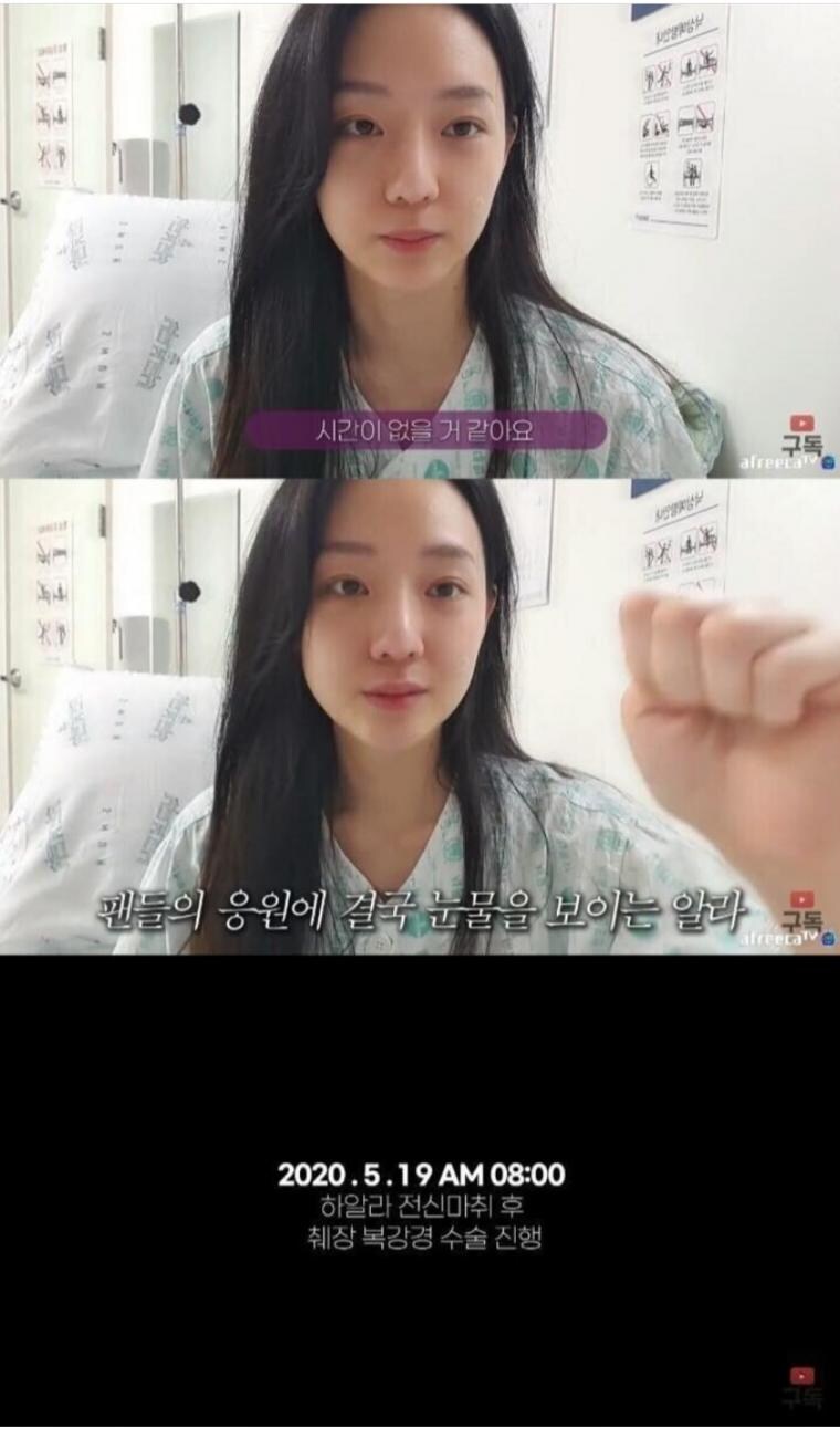 정말 운좋게 췌장암 발견해서 치료받은 유튜버_5.jpg