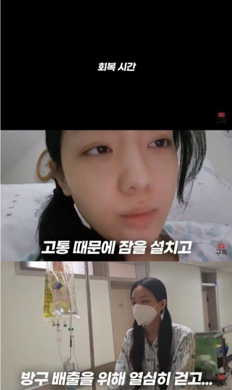 정말 운좋게 췌장암 발견해서 치료받은 유튜버_7.jpg