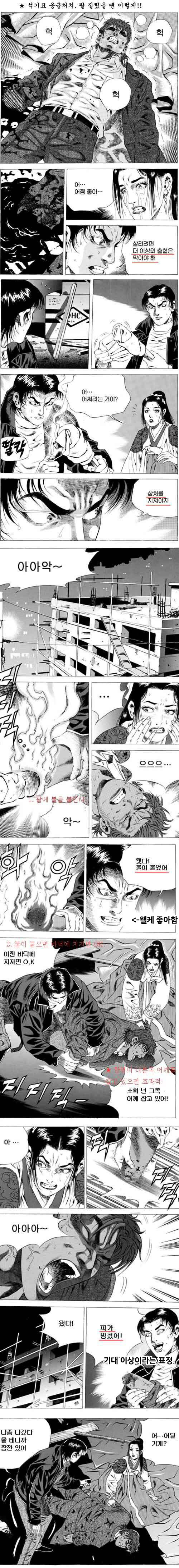 테토남식 상처 치유법_1.jpg