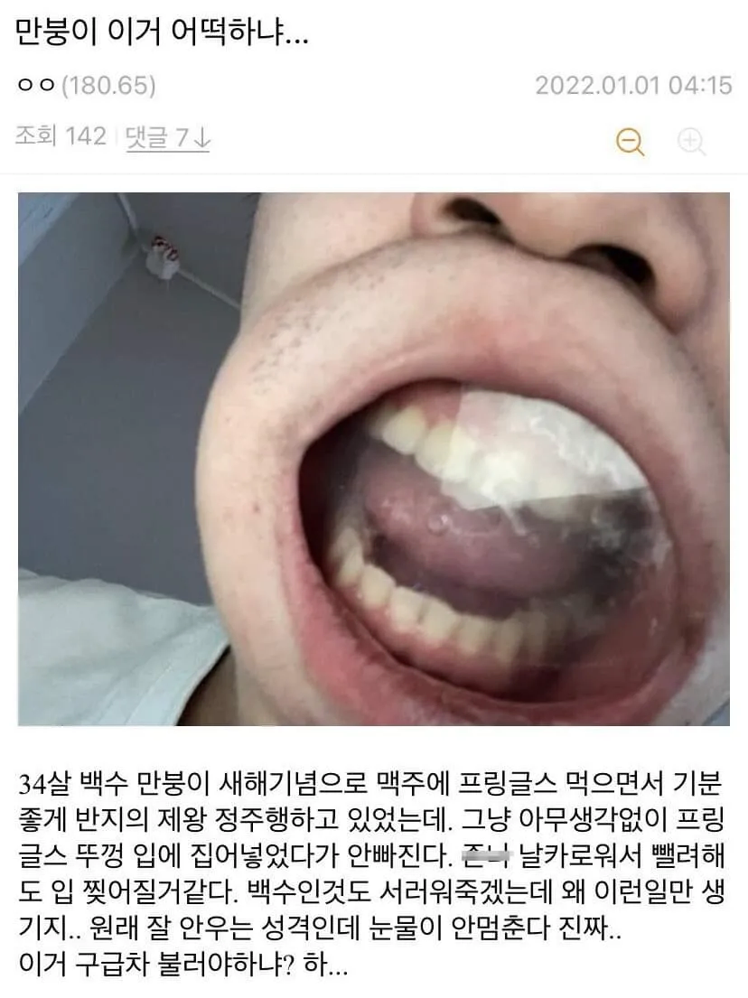 술김에 장난으로 입에 넣은 프링글스 뚜껑이 입에 낀 아조씨.jpg_1.webp