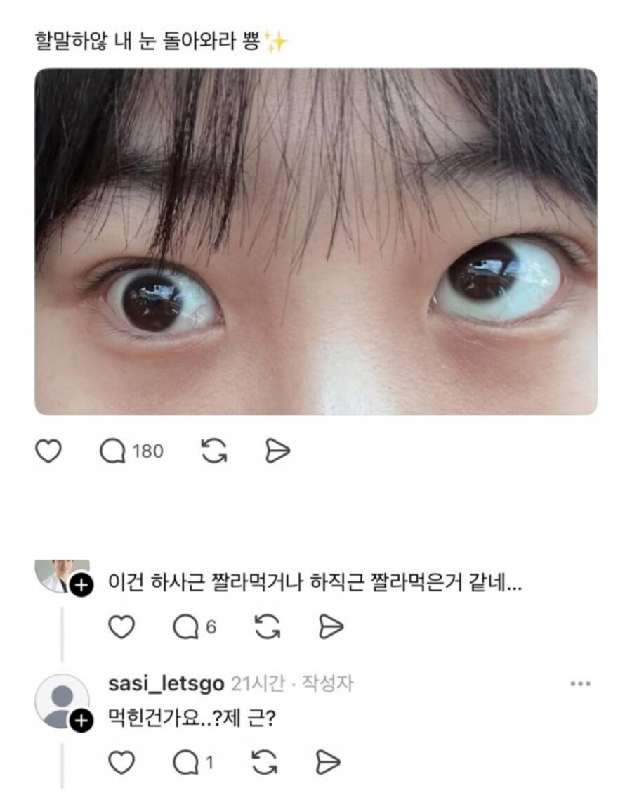 눈밑 지방제거술 후기.jpg_2.jpg