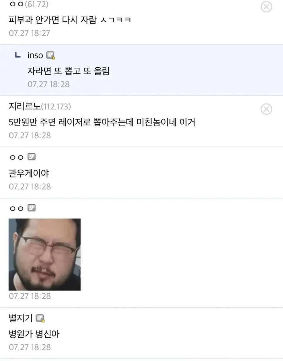혐) 손에 자란 사마귀 뽑음_2.webp