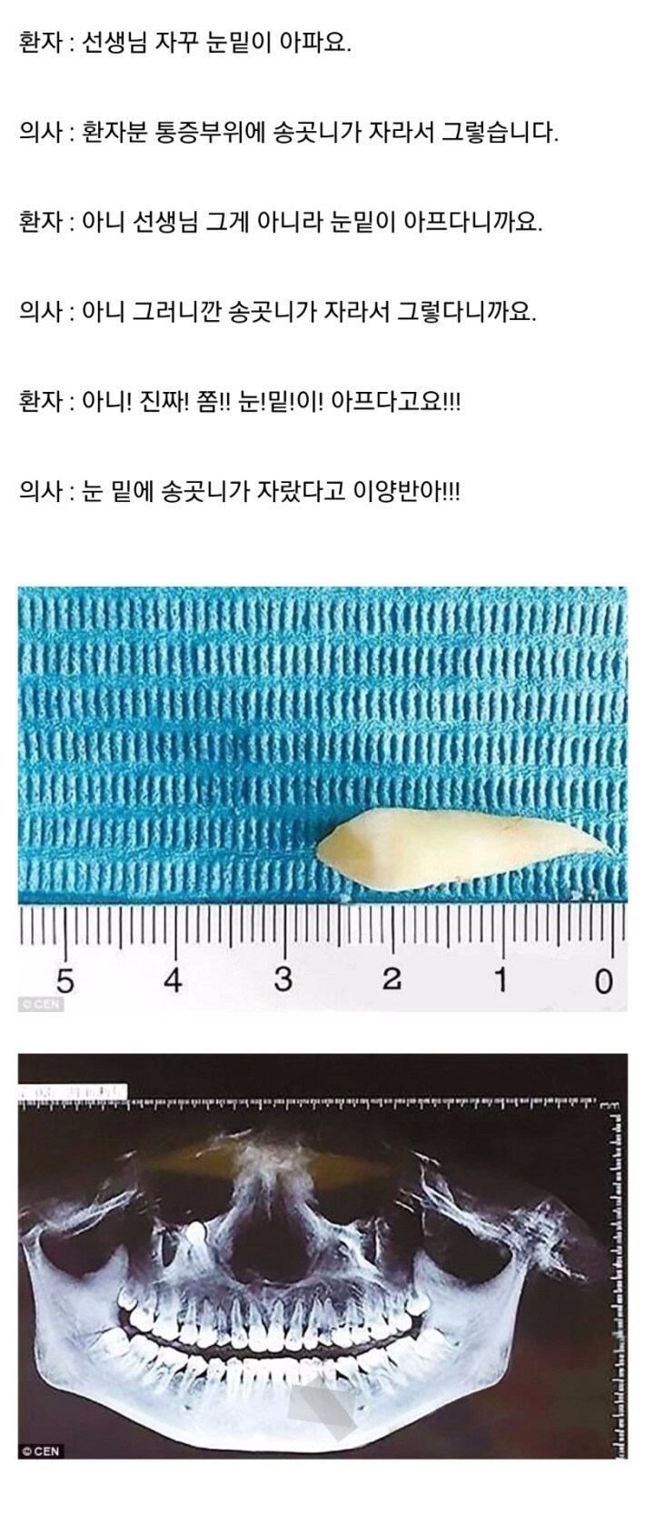 ???: 눈이 아픈데 왜 치과로 가라는..._1.jpg