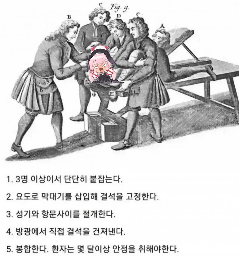 과거 요로결석 치료방법_1.jpg