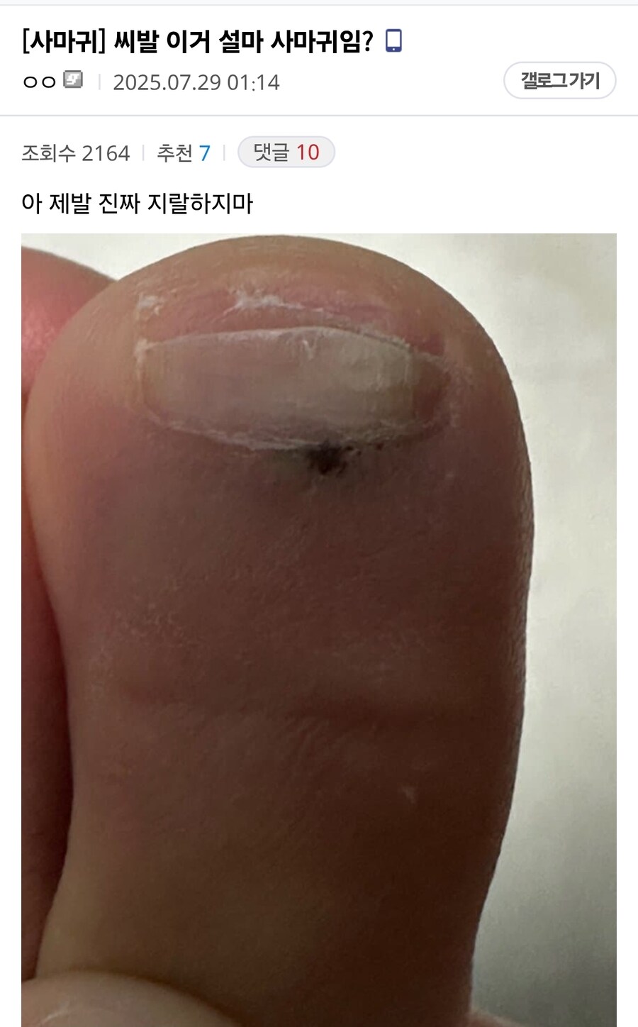간만에 도래창빌런 생각나서 티눈갤 구경갔다가_1.jpg