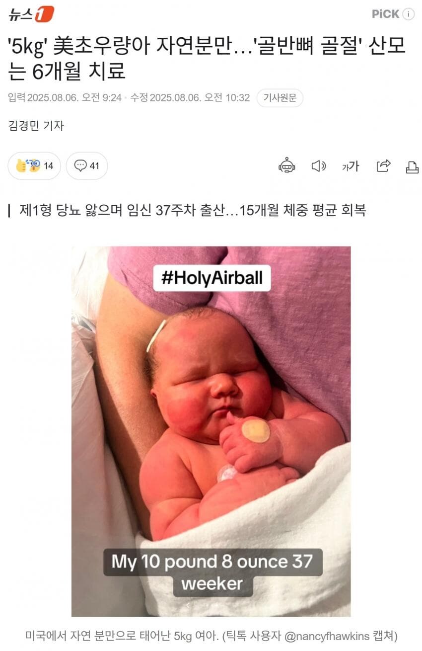 5㎏ 초우량아 자연분만…산모는 골반뼈골절_1.jpg