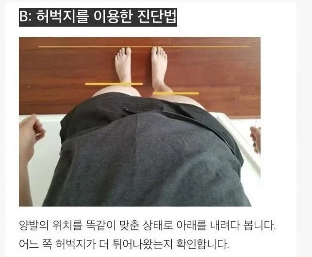 간단하게 골반 틀어졌는지 확인법 jpg._1.jpg