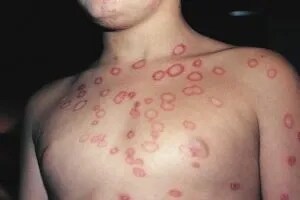 길고양이가 다가와도 함부로 만지면 안되는 이유.jpg_2.jpg