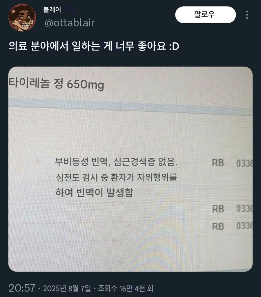 심전도 검사중 자위행위로 빈맥 발생_1.jpg