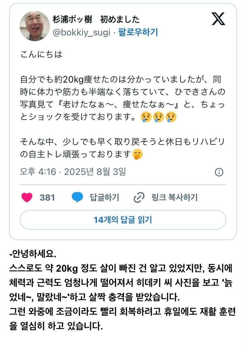 희귀병으로 활동중단한 AV배우_4.jpg