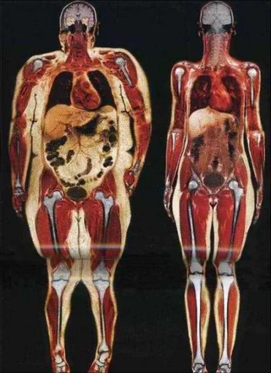 110kg 여성과 55kg 여성 바디스캔_1.jpg