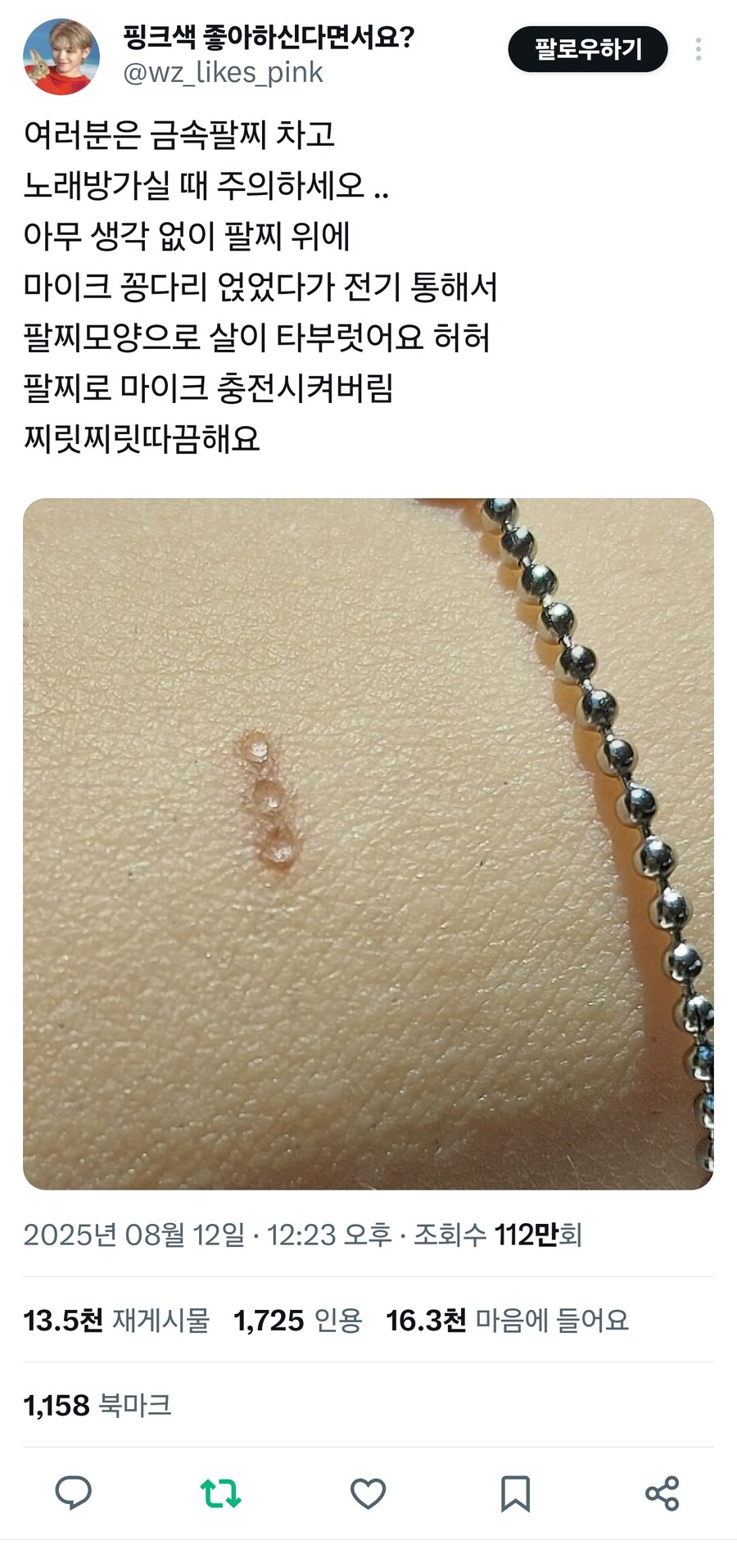 노래방갈때 금속팔찌를 끼면 안되는 이유_1.jpg