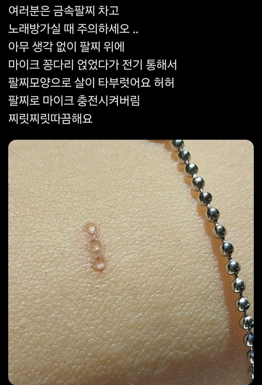 금속팔찌의 위험성_1.jpg