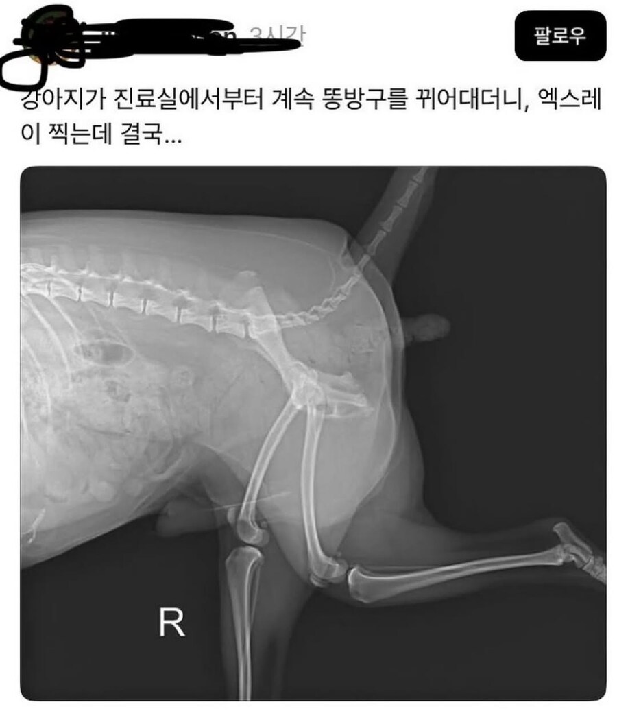 엑스레이 중에 방구가 계속 나오더니 결국...jpg_1.jpg
