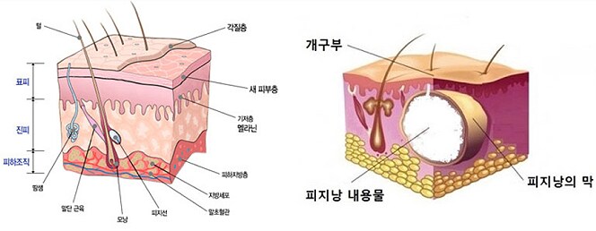 의사 선생님 의심해서 죄송합니다..._1.png