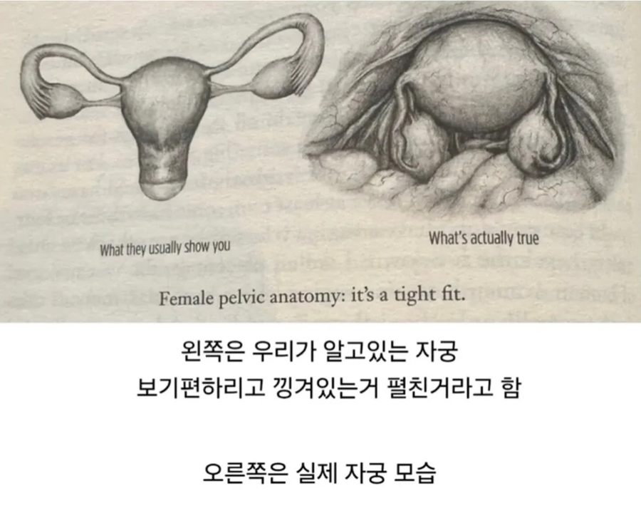 실제 자궁모습_1.webp
