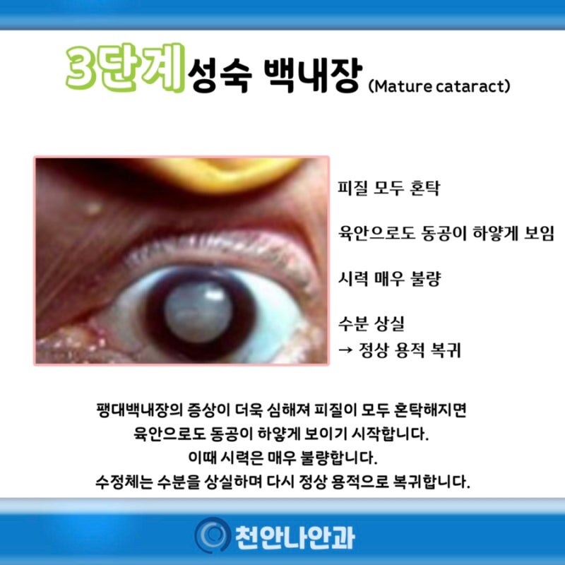 안과의사가 귀멸 영화에 집중못한 이유_2.jpg