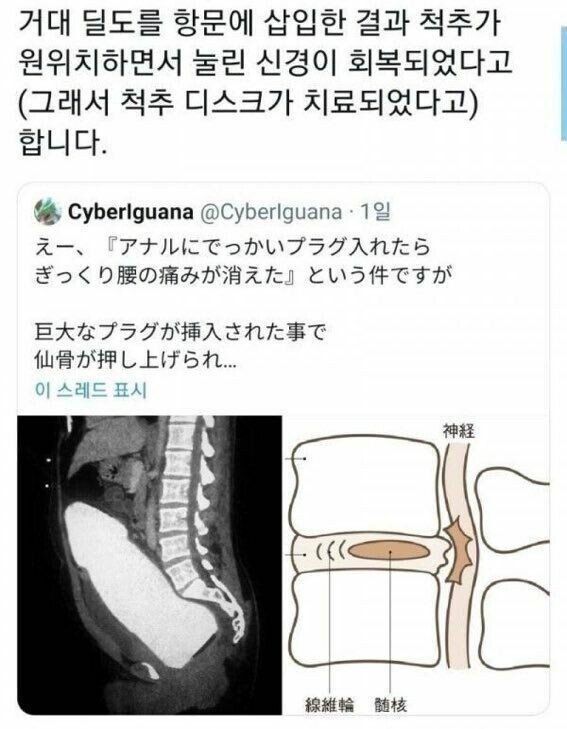 거대 딜도 넣고 병원감.jpg_1.jpg