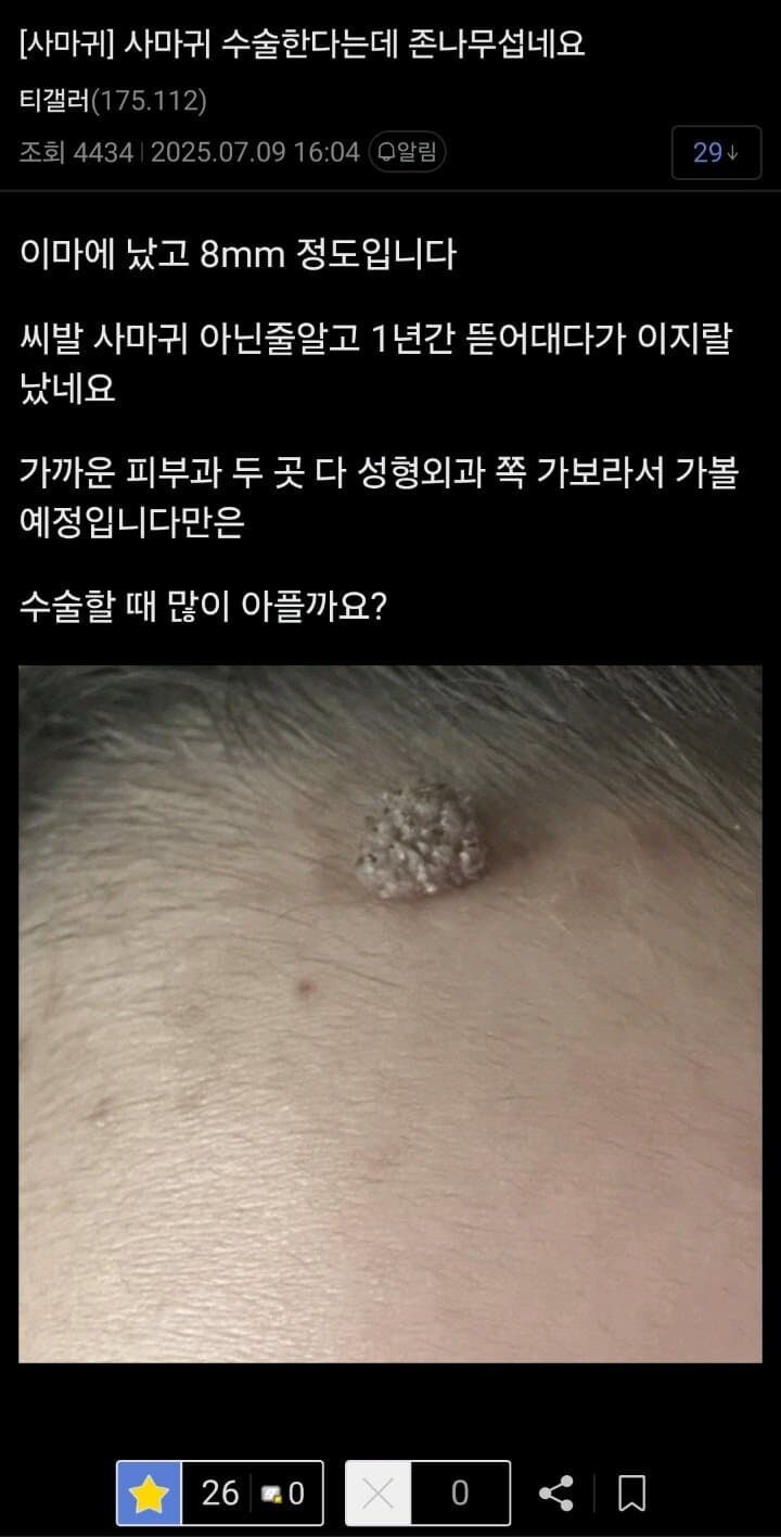 이마에 난 8cm 사마귀가 그거 닮음._1.jpg