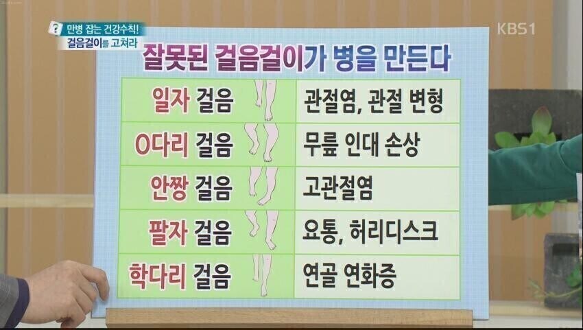 잘못된 걸음걸이가 병을 만든다_1.jpg