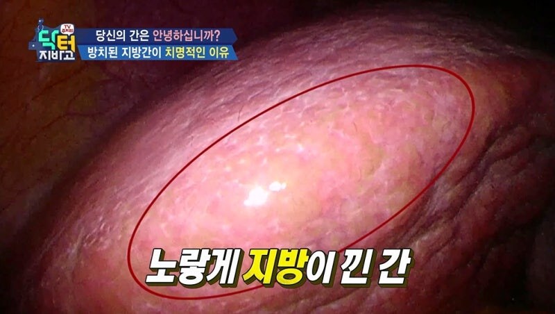 비만인들 특징.jpg_1.jpg