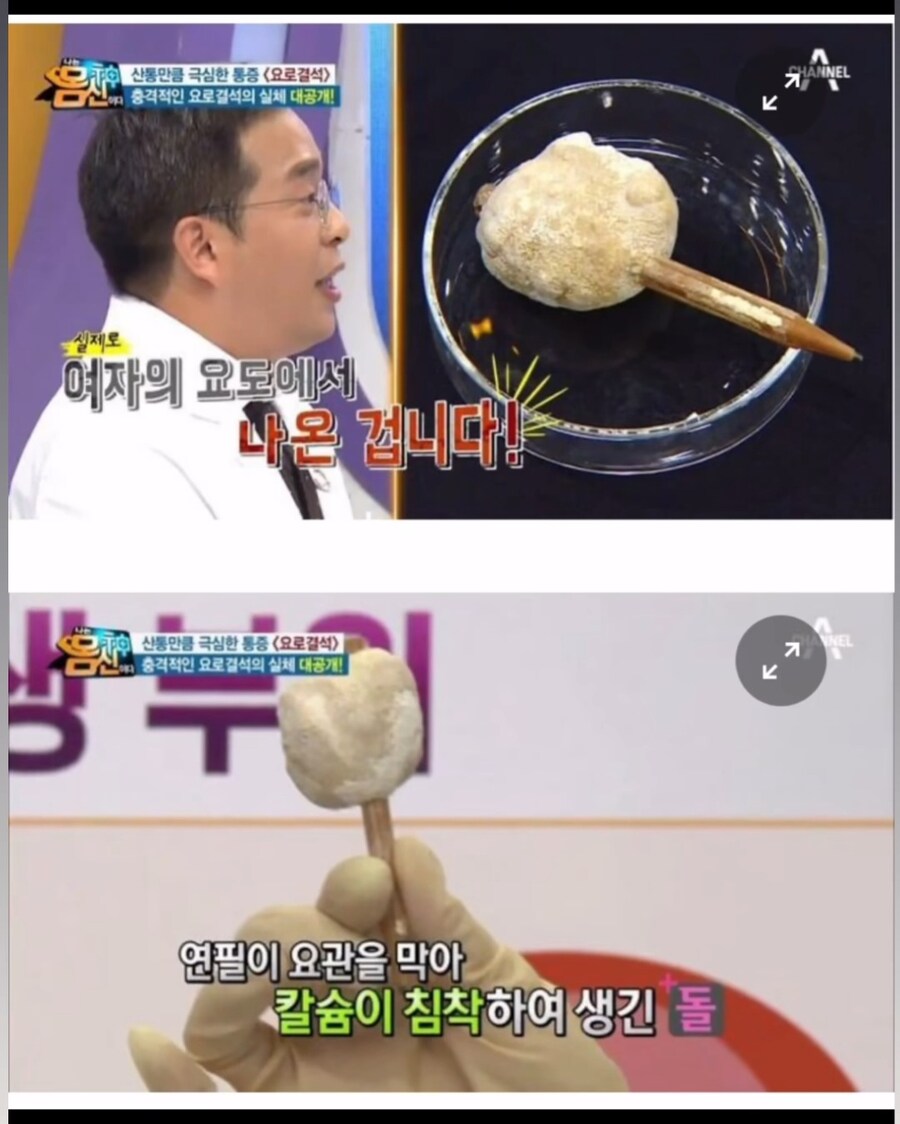 여성 성기에