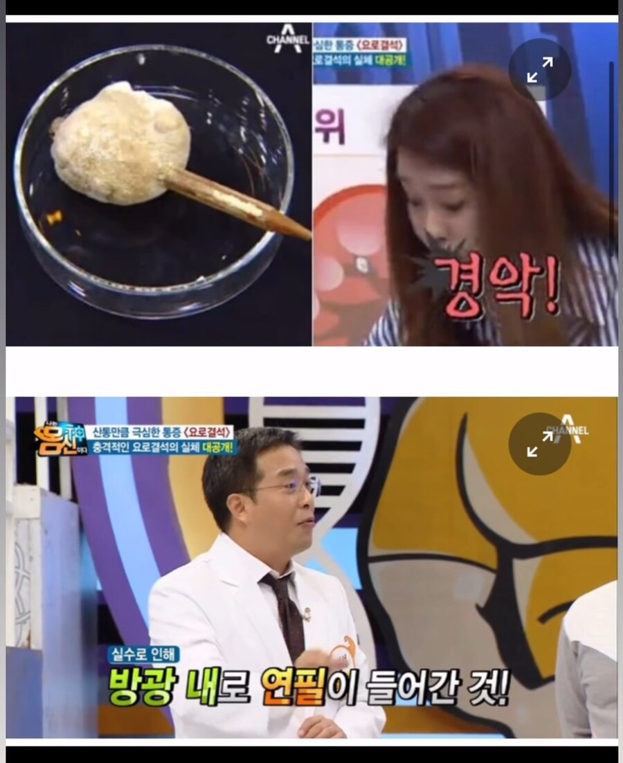 여성 성기에