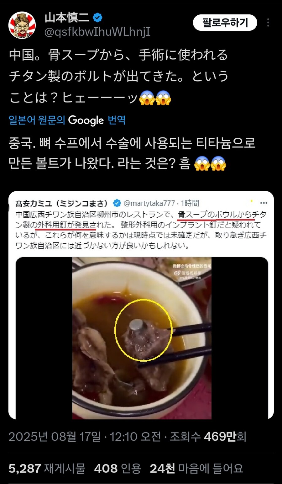 음식집 수프에서 그냥 쇳조각이 나온것도 아니고 무려_1.jpg