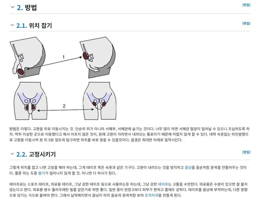 여장러들이 고환을 감추는 방법_1.jpg