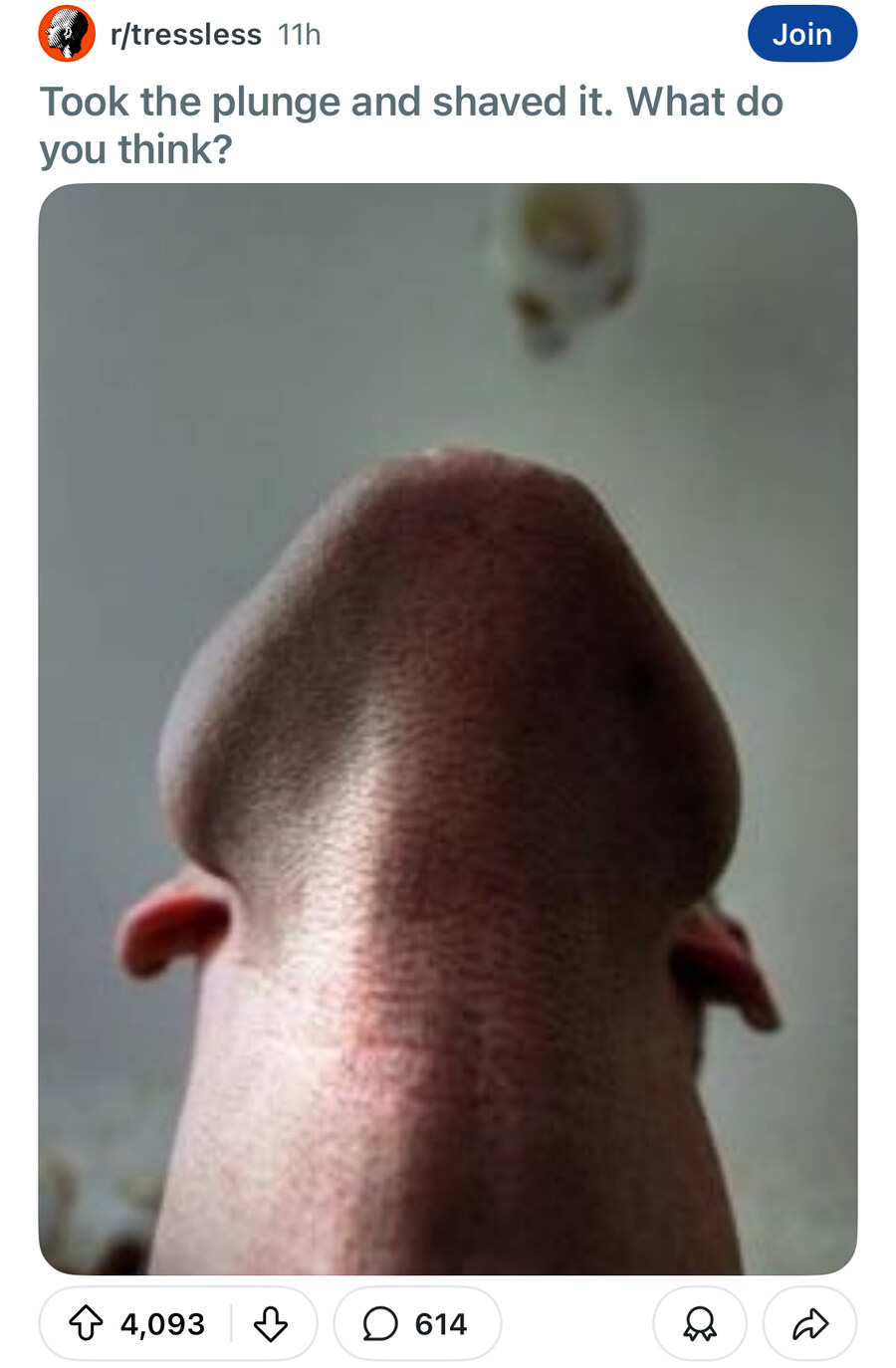 자기 면도한 거 어떠냐고 묻는 레딧 유저.jpg_1.jpg