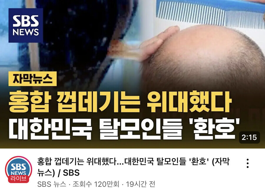 홍합이 대머리를 핥는거 아님.jpg_1.jpg