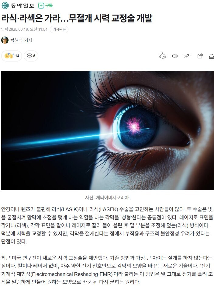 라식 라섹 한사람들 울고불고 후회하게 할 기술 개발.jpg_1.jpg