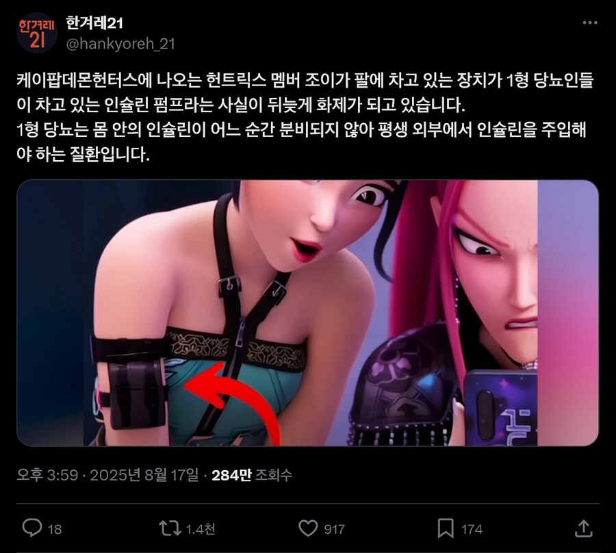 케데헌) 조이의 팔에 착용한 파우치가 인슐린펌프라는 기사가 나온 이유._1.png