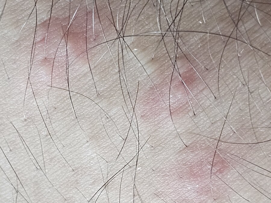 혐) 모기가 3점사를 하네_2.jpg