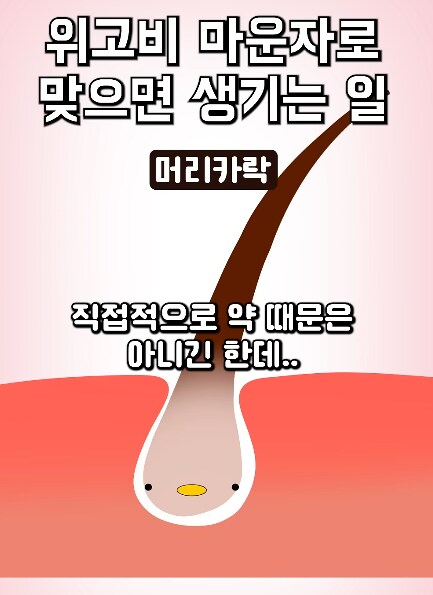 위고비, 마운자 안맞기로 결정했다_1.png