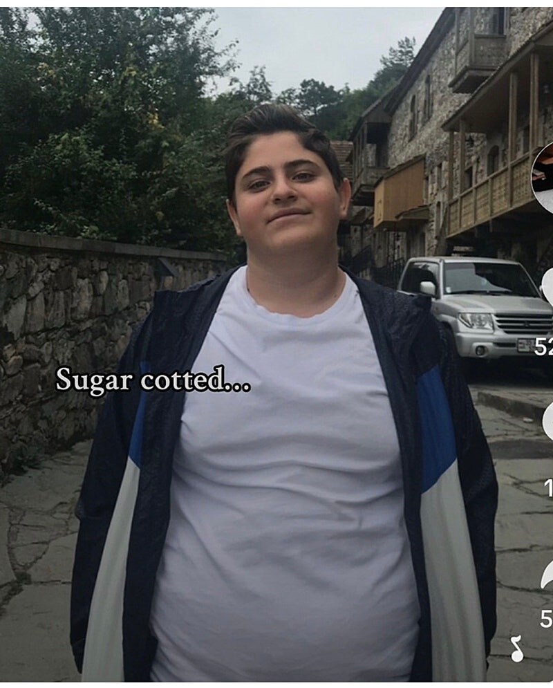 35kg 뺀 사람 비포 애프터 ㄷㄷㄷ;;_3.jpg