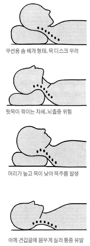 가장 올바른 수면시 베개 배는 자세.jpg_1.jpg