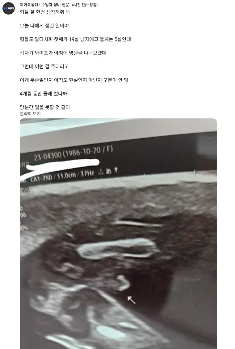 형제 나이 차이 20살 입장 ㅎㅎㅎㅎ_1.png