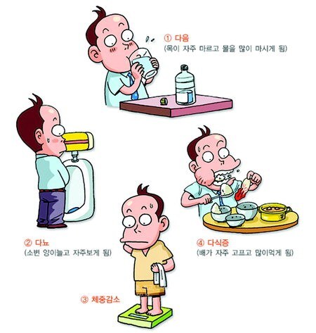 당뇨 전조 증상 중 가장 안좋은 신호.jpg_1.jpg