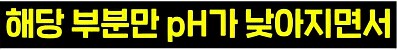 라식, 라섹은 끝났다 시력교정 게임체인저_6.png