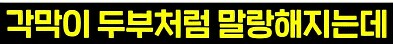 라식, 라섹은 끝났다 시력교정 게임체인저_7.png