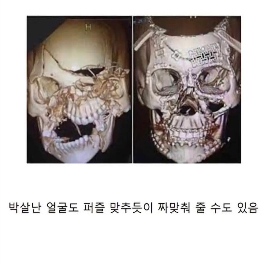 고도로 발달 한 현대의학으로도 불가능한 영역_2.jpg