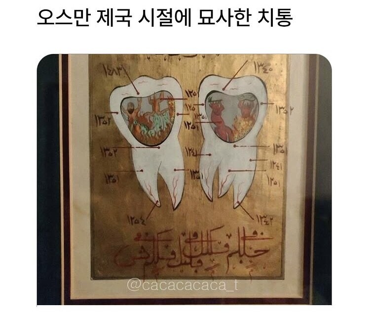 치통이 주는 고통을 묘사한 그림_1.jpg