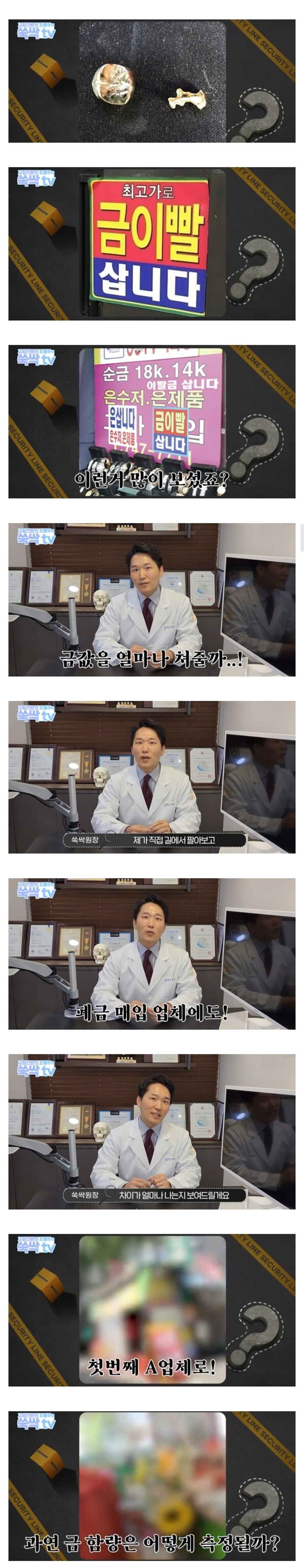 금이빨을 길거리 매입업체에 팔면 안되는 이유_1.jpg