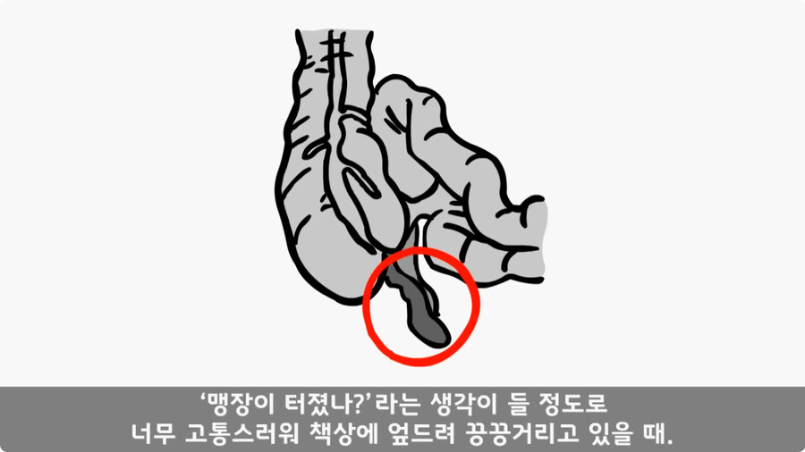 돌맹이를 낳은 일병.jpg_9.jpg